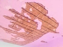 Chelur Karnataka Public School ceiling collapse